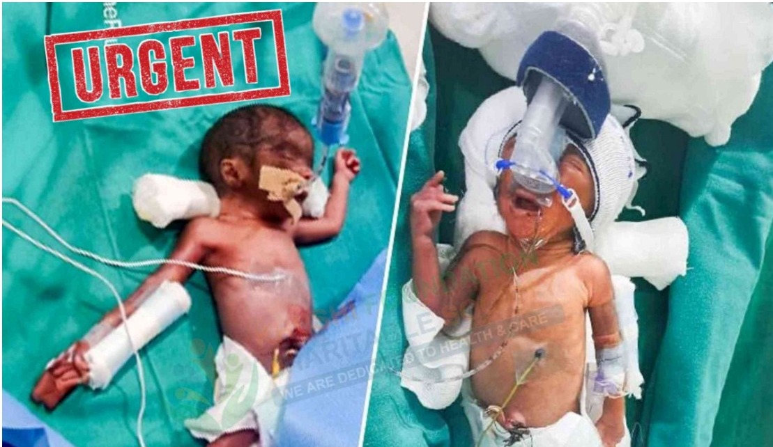 Twin Baby_1